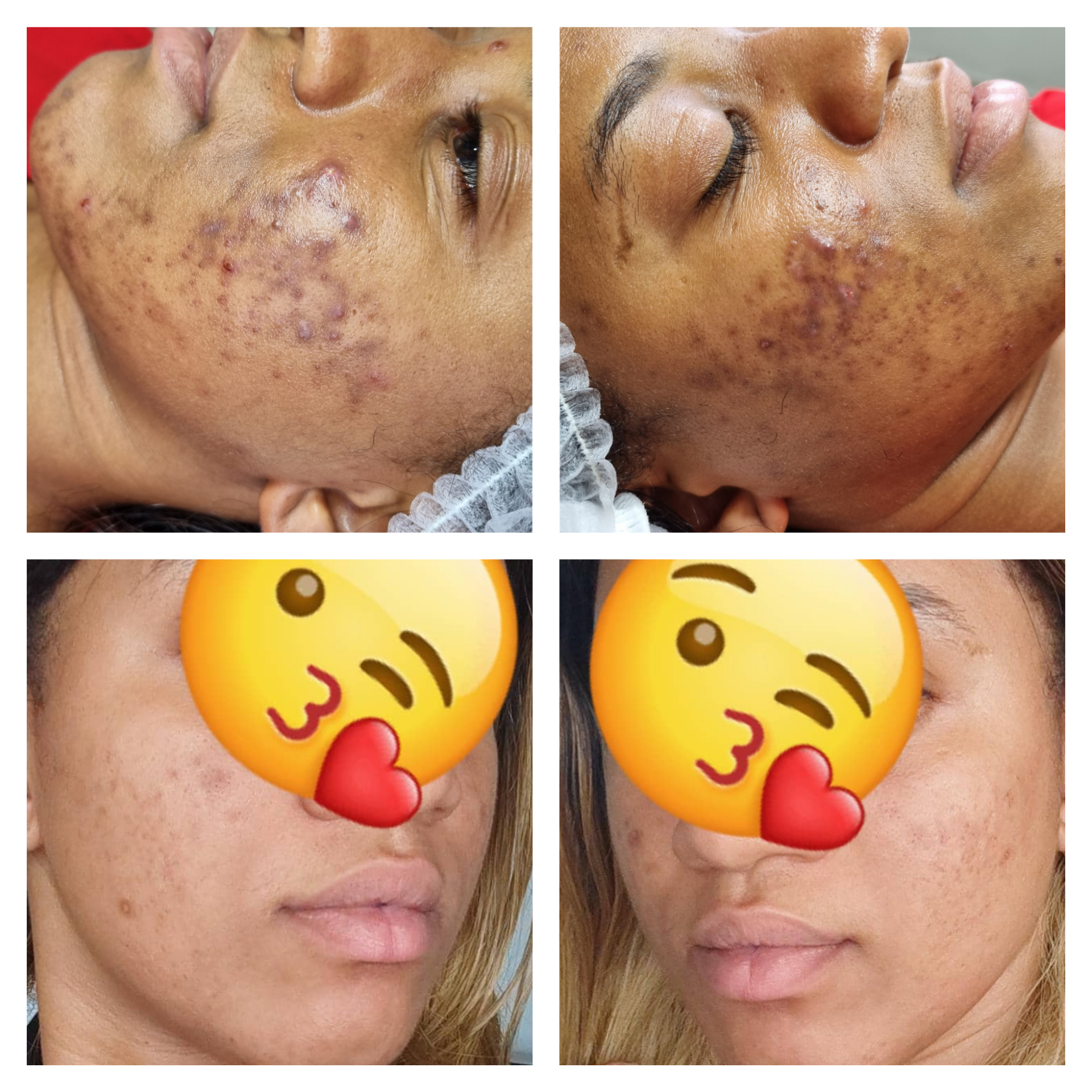 InShot_20220314_172005415